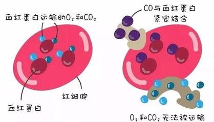 警惕洗澡季隱形殺手 一氧化碳中毒康復后，當心遲發(fā)性腦病
